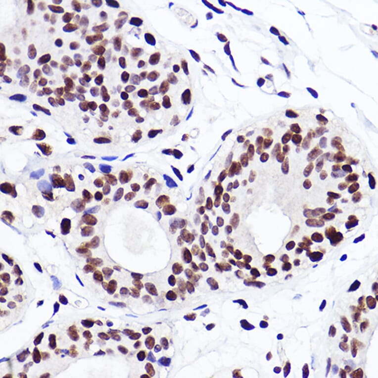 Immunohistochemistry - Anti-Histone H3 (mono methyl Lys18) Antibody [ARC2621] (A305387) - Antibodies.com