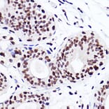 Immunohistochemistry - Anti-Histone H3 (mono methyl Lys18) Antibody [ARC2621] (A305387) - Antibodies.com