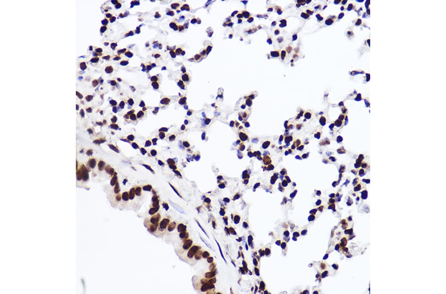 Immunohistochemistry - Anti-Histone H3 (mono methyl Lys18) Antibody [ARC2621] (A305387) - Antibodies.com