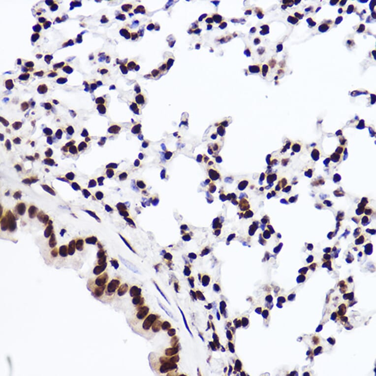 Immunohistochemistry - Anti-Histone H3 (mono methyl Lys18) Antibody [ARC2621] (A305387) - Antibodies.com