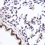 Immunohistochemistry - Anti-Histone H3 (mono methyl Lys18) Antibody [ARC2621] (A305387) - Antibodies.com