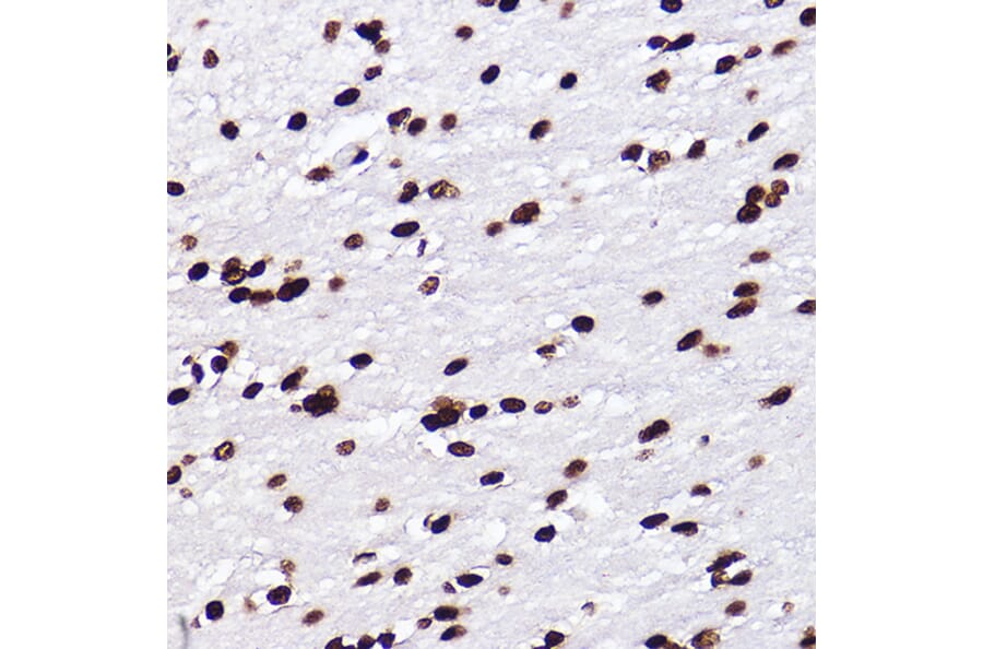 Immunohistochemistry - Anti-Histone H3 (mono methyl Lys18) Antibody [ARC2621] (A305387) - Antibodies.com