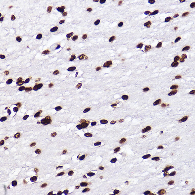 Immunohistochemistry - Anti-Histone H3 (mono methyl Lys18) Antibody [ARC2621] (A305387) - Antibodies.com