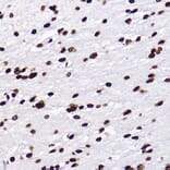 Immunohistochemistry - Anti-Histone H3 (mono methyl Lys18) Antibody [ARC2621] (A305387) - Antibodies.com