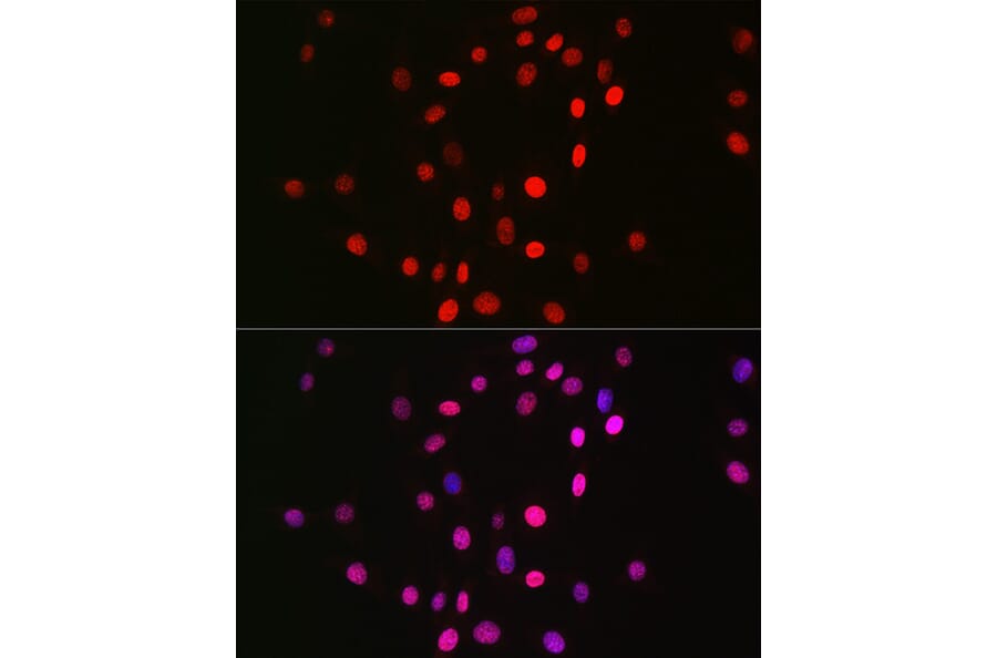 Immunofluorescence - Anti-Histone H3 (mono methyl Lys18) Antibody [ARC2621] (A305387) - Antibodies.com