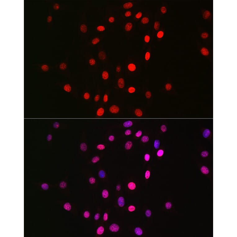 Immunofluorescence - Anti-Histone H3 (mono methyl Lys18) Antibody [ARC2621] (A305387) - Antibodies.com