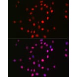 Immunofluorescence - Anti-Histone H3 (mono methyl Lys18) Antibody [ARC2621] (A305387) - Antibodies.com
