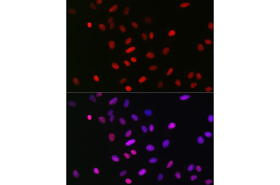 Immunofluorescence - Anti-Histone H3 (mono methyl Lys18) Antibody [ARC2621] (A305387) - Antibodies.com