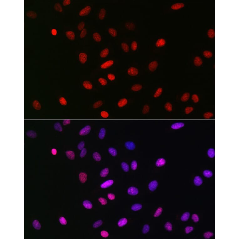 Immunofluorescence - Anti-Histone H3 (mono methyl Lys18) Antibody [ARC2621] (A305387) - Antibodies.com