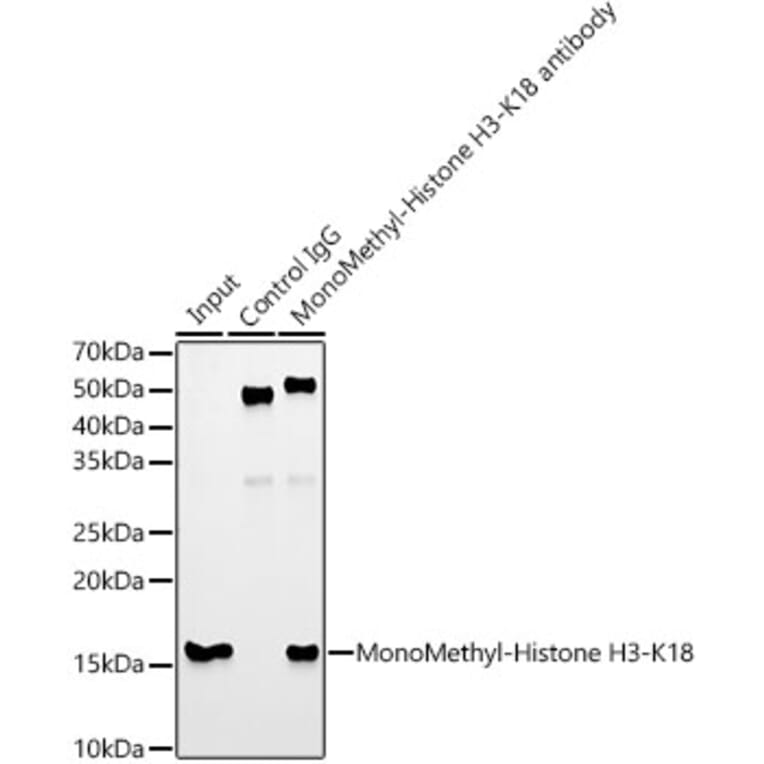 Western Blot - Anti-Histone H3 (mono methyl Lys18) Antibody [ARC2621] (A305387) - Antibodies.com