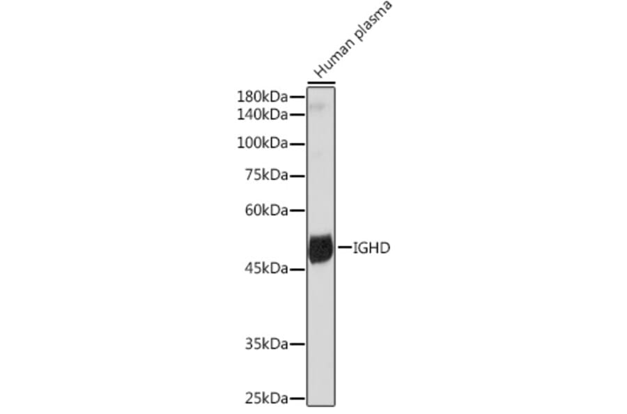 Western Blot - Anti-IgD Antibody [ARC2240] (A305388) - Antibodies.com