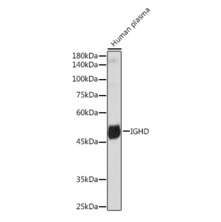 Western Blot - Anti-IgD Antibody [ARC2240] (A305388) - Antibodies.com
