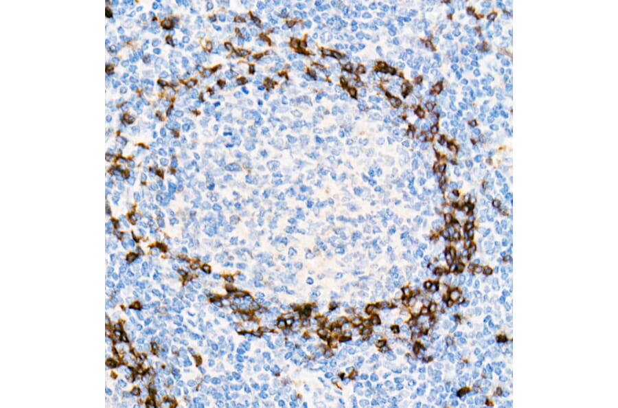 Immunohistochemistry - Anti-IgD Antibody [ARC2240] (A305388) - Antibodies.com