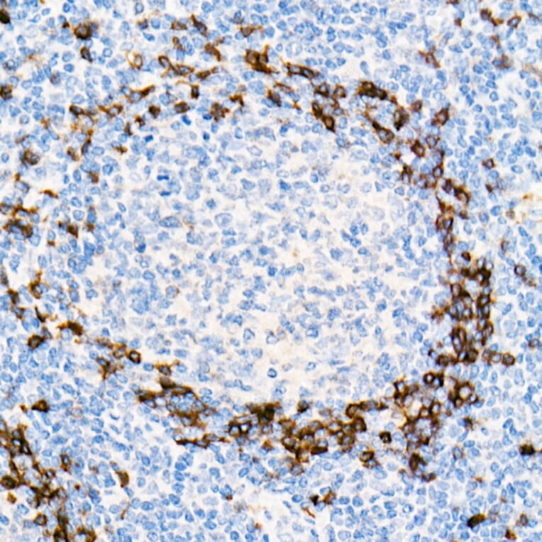 Immunohistochemistry - Anti-IgD Antibody [ARC2240] (A305388) - Antibodies.com