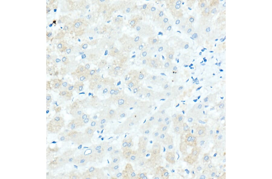 Immunohistochemistry - Anti-IgD Antibody [ARC2240] (A305388) - Antibodies.com
