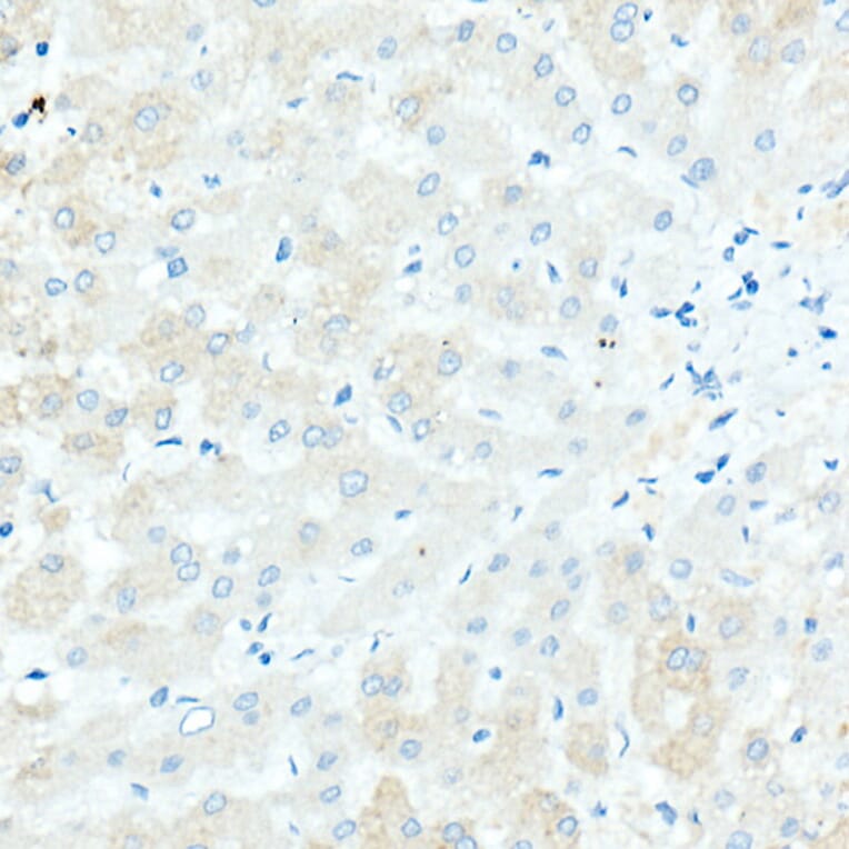 Immunohistochemistry - Anti-IgD Antibody [ARC2240] (A305388) - Antibodies.com