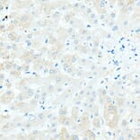 Immunohistochemistry - Anti-IgD Antibody [ARC2240] (A305388) - Antibodies.com