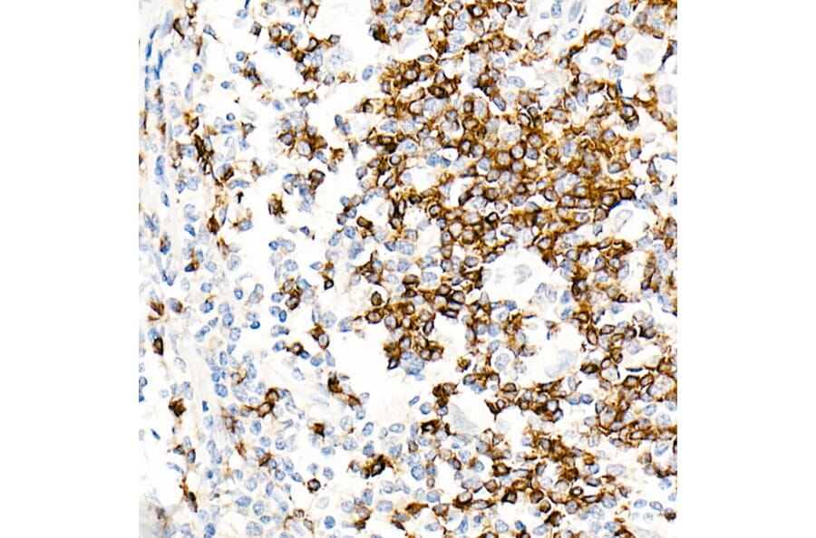 Immunohistochemistry - Anti-IgD Antibody [ARC2240] (A305388) - Antibodies.com