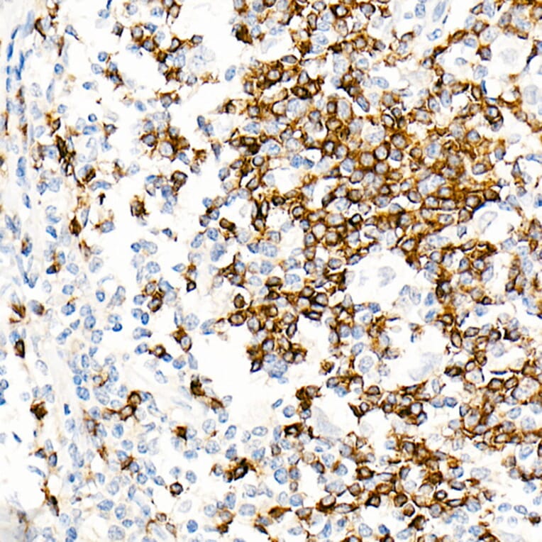 Immunohistochemistry - Anti-IgD Antibody [ARC2240] (A305388) - Antibodies.com