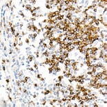 Immunohistochemistry - Anti-IgD Antibody [ARC2240] (A305388) - Antibodies.com