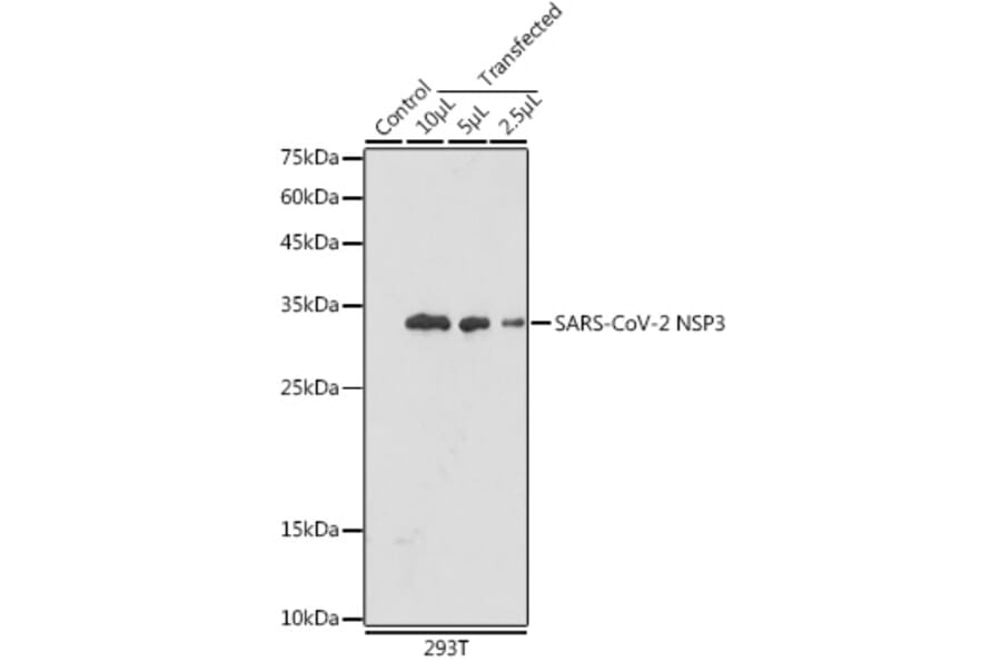 Western Blot - Anti-SARS-CoV2 NSP3 Antibody (A305389) - Antibodies.com