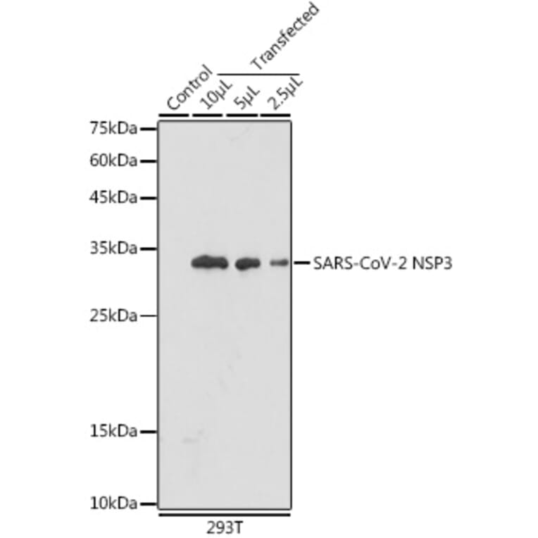 Western Blot - Anti-SARS-CoV2 NSP3 Antibody (A305389) - Antibodies.com