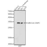 Western Blot - Anti-SARS-CoV2 NSP3 Antibody (A305389) - Antibodies.com