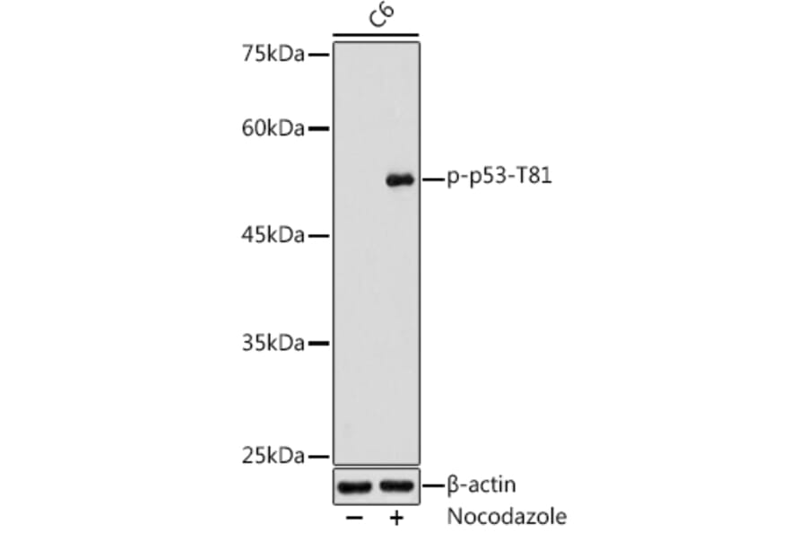 Western Blot - Anti-p53 (phospho Thr81) Antibody (A305390) - Antibodies.com