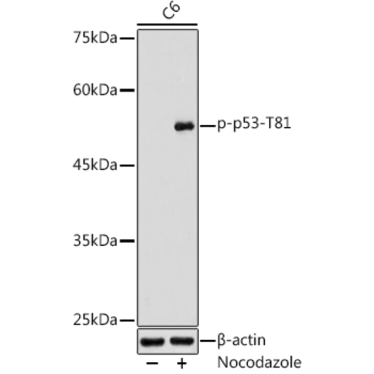 Western Blot - Anti-p53 (phospho Thr81) Antibody (A305390) - Antibodies.com