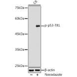 Western Blot - Anti-p53 (phospho Thr81) Antibody (A305390) - Antibodies.com