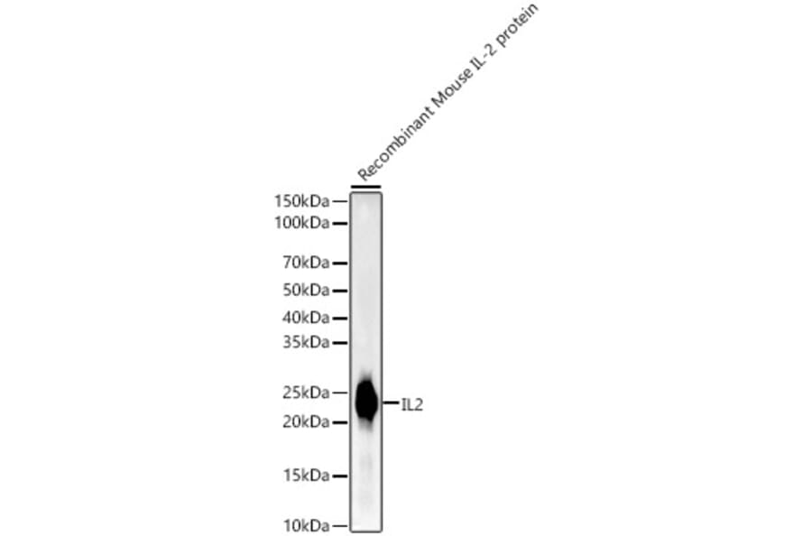 Western Blot - Anti-IL-2 Antibody [ARC55614] (A305391) - Antibodies.com