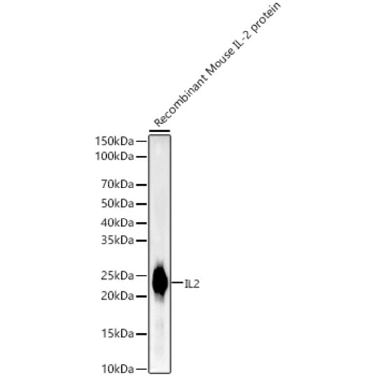 Western Blot - Anti-IL-2 Antibody [ARC55614] (A305391) - Antibodies.com