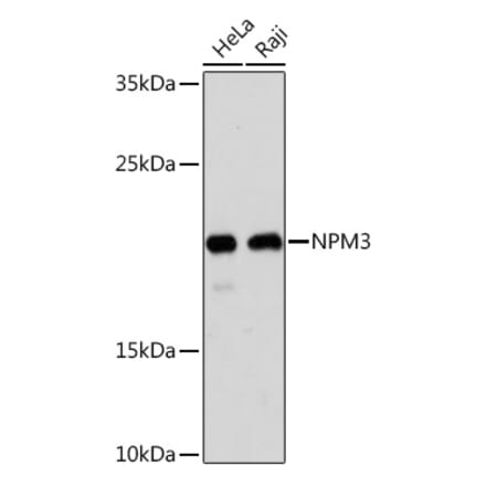 Western Blot - Anti-NPM3 Antibody (A305394) - Antibodies.com