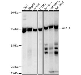 Western Blot - Anti-ACAT1 Antibody [ARC2929] (A305395) - Antibodies.com