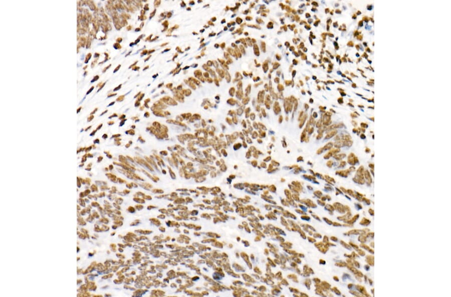 Immunohistochemistry - Anti-STAT3 (phospho Tyr705) Antibody [ARC50831] (A305396) - Antibodies.com