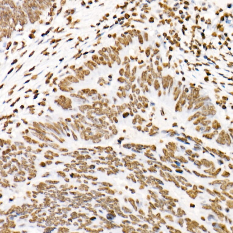 Immunohistochemistry - Anti-STAT3 (phospho Tyr705) Antibody [ARC50831] (A305396) - Antibodies.com