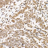 Immunohistochemistry - Anti-STAT3 (phospho Tyr705) Antibody [ARC50831] (A305396) - Antibodies.com