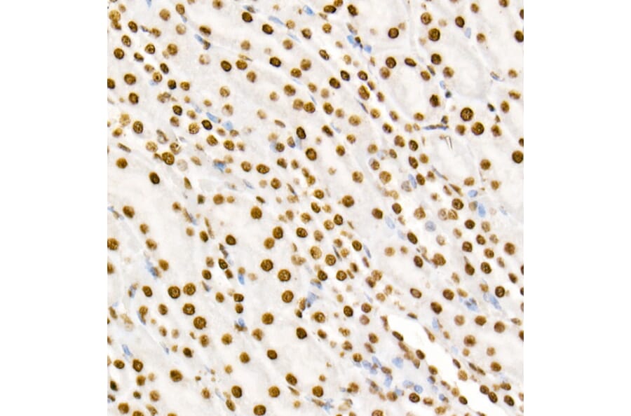 Immunohistochemistry - Anti-STAT3 (phospho Tyr705) Antibody [ARC50831] (A305396) - Antibodies.com