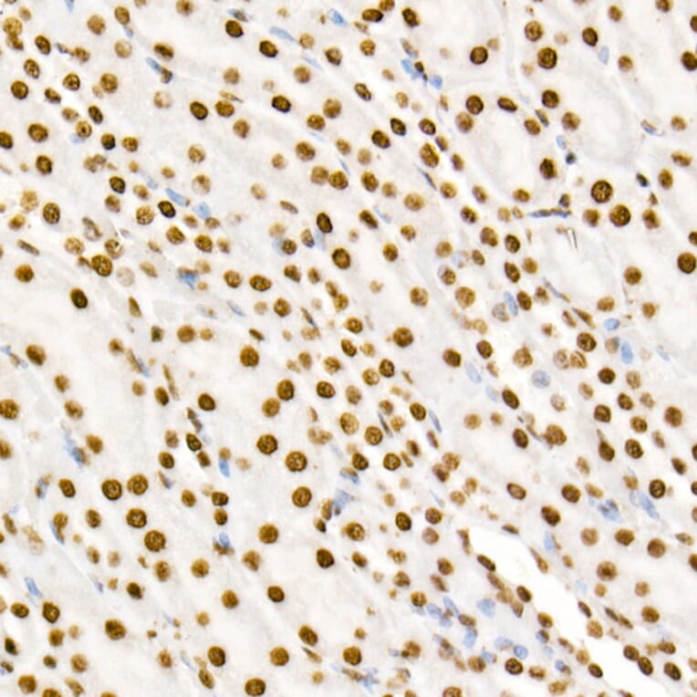Immunohistochemistry - Anti-STAT3 (phospho Tyr705) Antibody [ARC50831] (A305396) - Antibodies.com