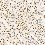 Immunohistochemistry - Anti-STAT3 (phospho Tyr705) Antibody [ARC50831] (A305396) - Antibodies.com