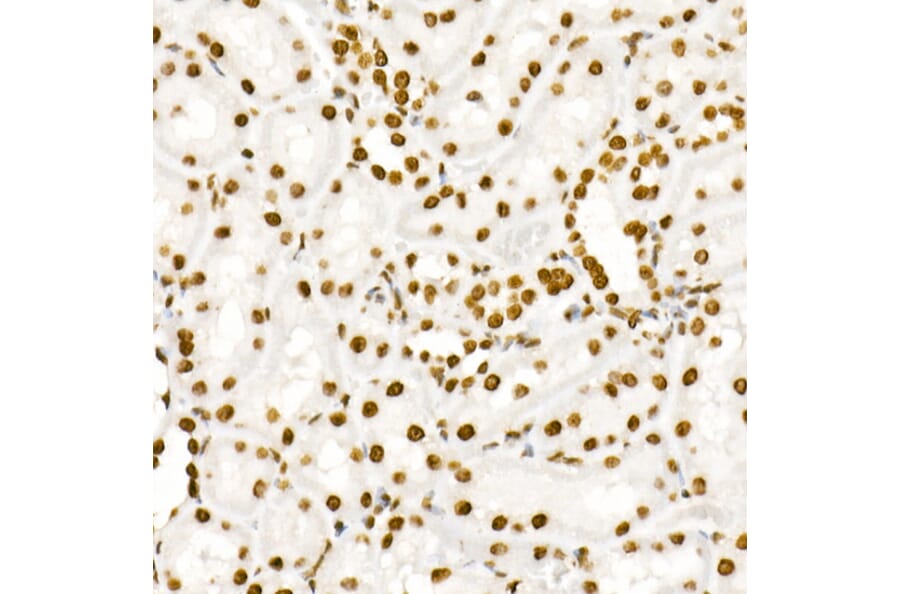 Immunohistochemistry - Anti-STAT3 (phospho Tyr705) Antibody [ARC50831] (A305396) - Antibodies.com