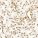 Immunohistochemistry - Anti-STAT3 (phospho Tyr705) Antibody [ARC50831] (A305396) - Antibodies.com