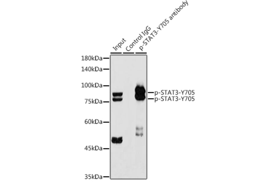 Western Blot - Anti-STAT3 (phospho Tyr705) Antibody [ARC50831] (A305396) - Antibodies.com