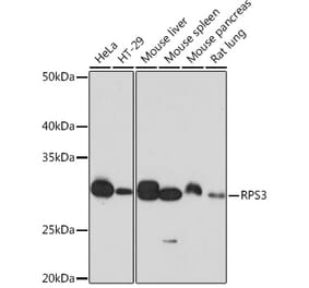 Western Blot - Anti-RPS3 Antibody [ARC0302] (A305397) - Antibodies.com
