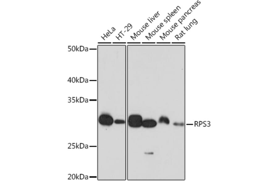 Western Blot - Anti-RPS3 Antibody [ARC0302] (A305397) - Antibodies.com
