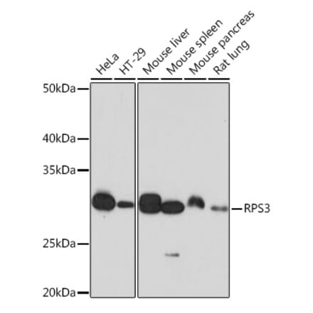 Western Blot - Anti-RPS3 Antibody [ARC0302] (A305397) - Antibodies.com