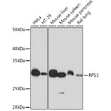 Western Blot - Anti-RPS3 Antibody [ARC0302] (A305397) - Antibodies.com