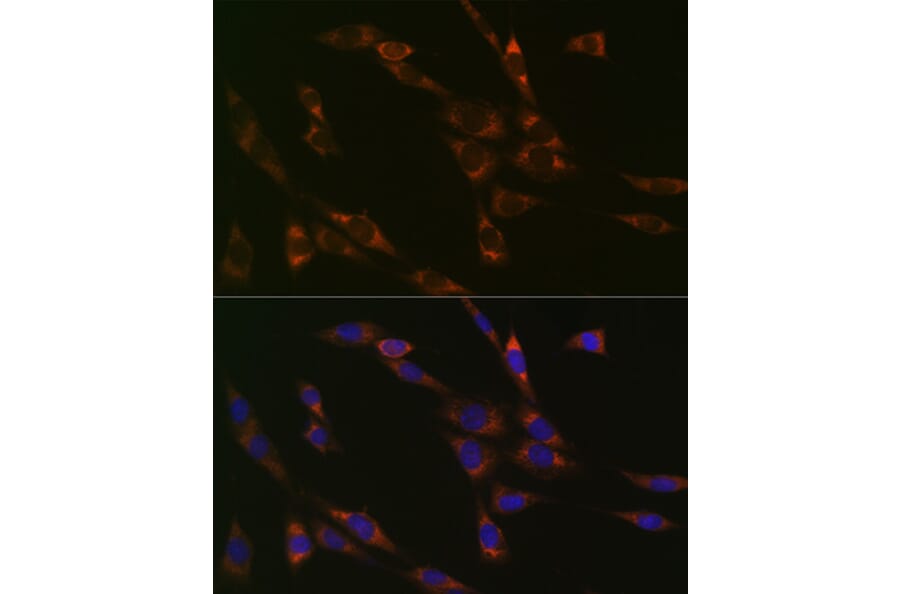 Immunofluorescence - Anti-RPS3 Antibody [ARC0302] (A305397) - Antibodies.com
