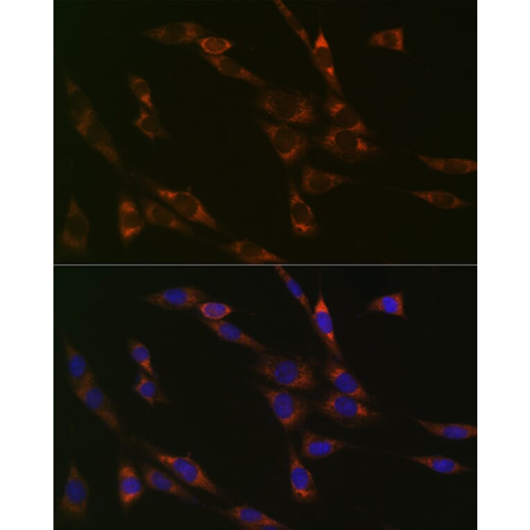 Immunofluorescence - Anti-RPS3 Antibody [ARC0302] (A305397) - Antibodies.com