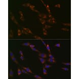 Immunofluorescence - Anti-RPS3 Antibody [ARC0302] (A305397) - Antibodies.com